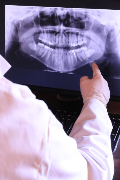 Best Emergency Dental Care for Sports Injuries in Fort Sumner, NM